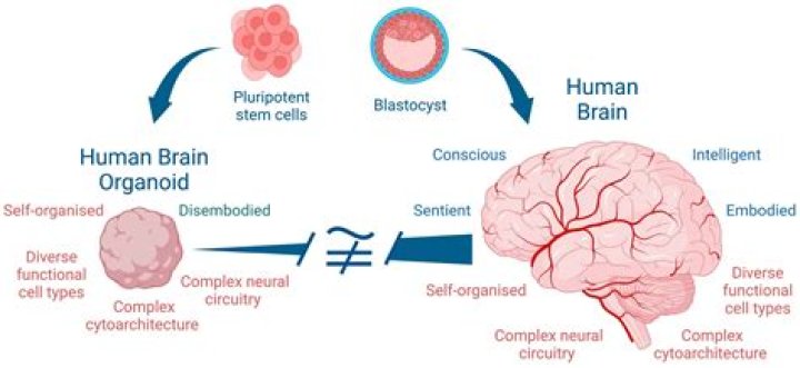 Can a human brain be cloned?