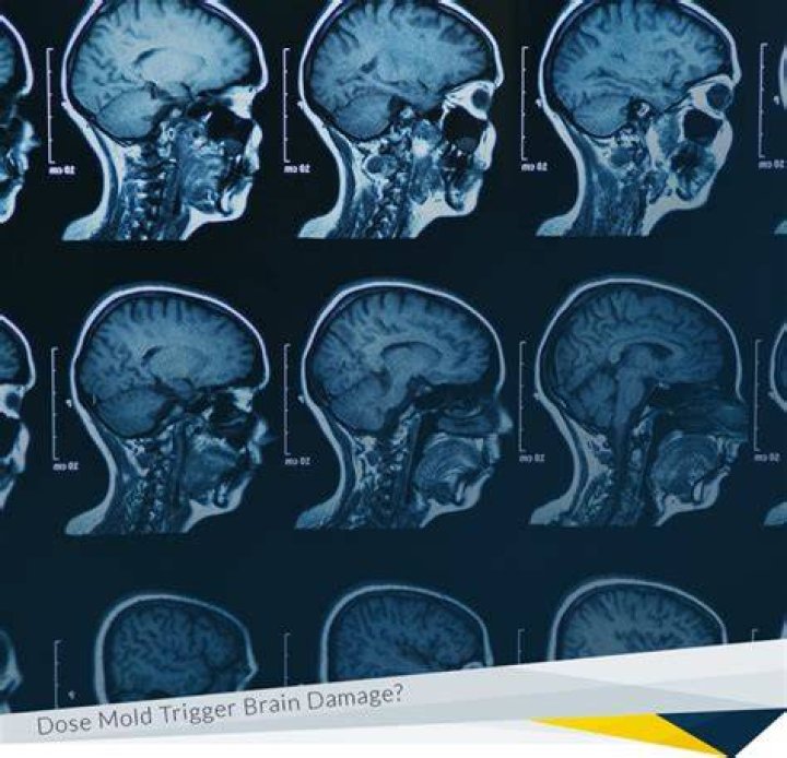 Can black mold damage brain?