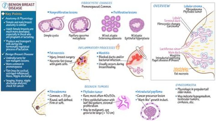 Can breast scar tissue become cancerous?