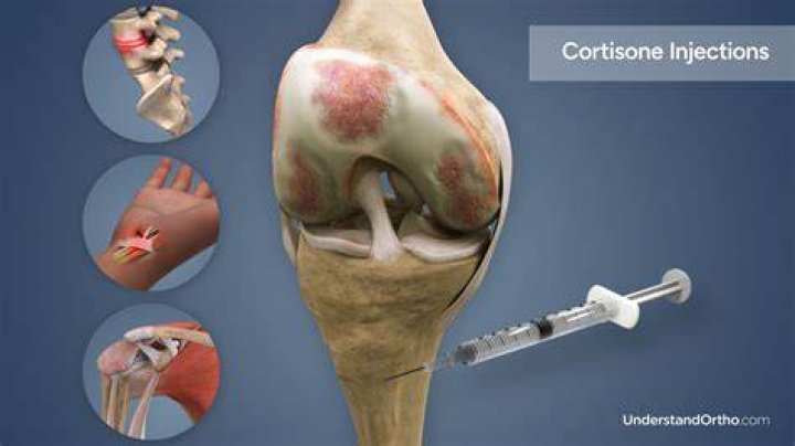 Do filling injections hurt?