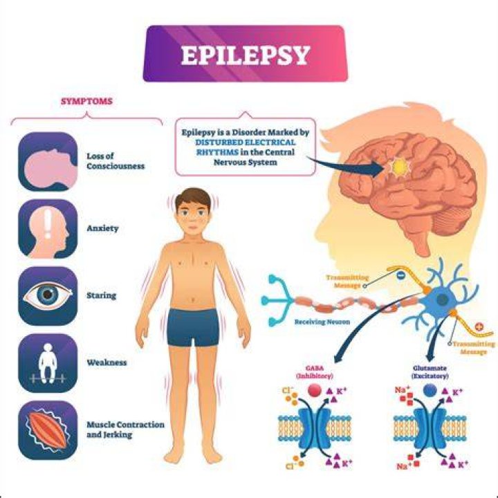 Does drinking water help epilepsy?