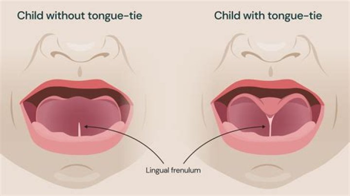 Is it true if you split a crows tongue it can talk?