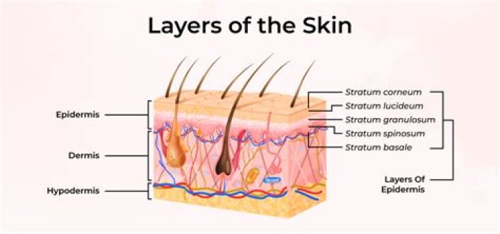 What are the two layers of a cast?