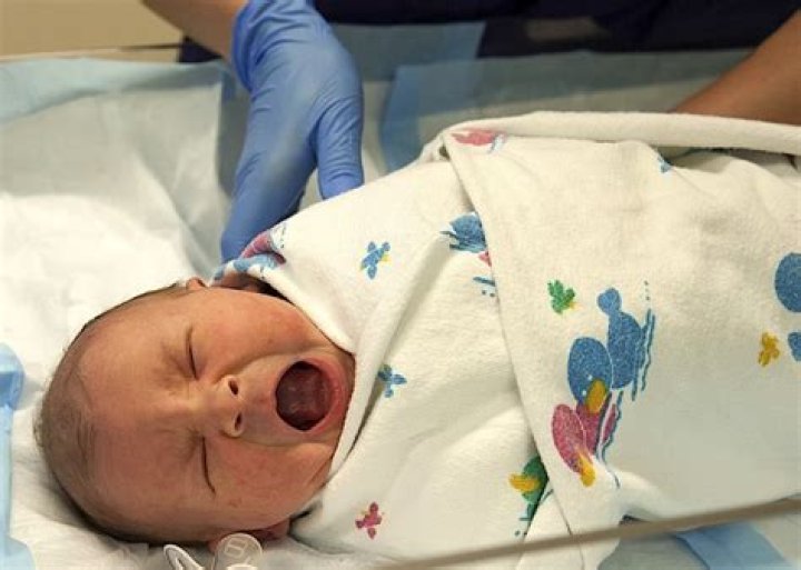 What does a baby crowning look like?