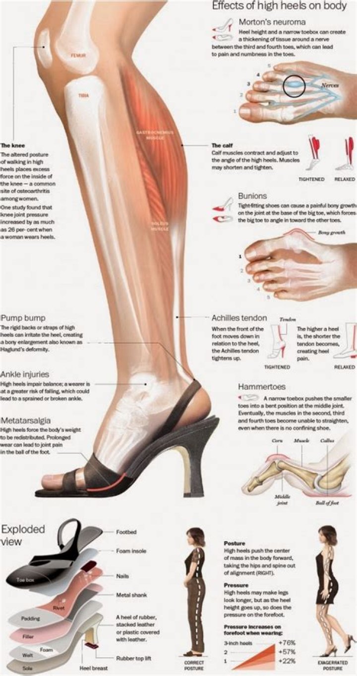 What happens if you wear heels everyday?