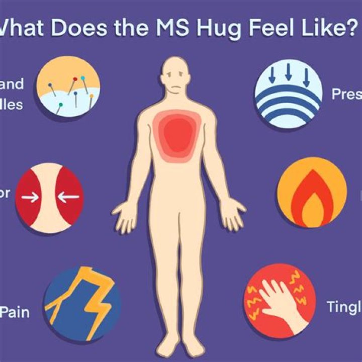 What is MS hug?