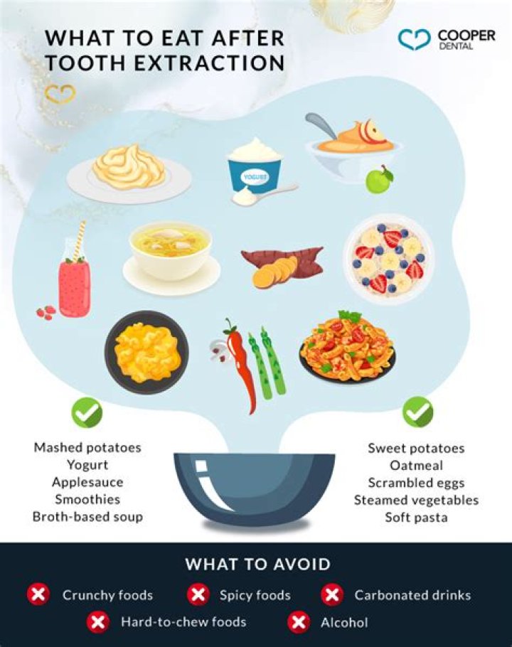 When can I eat a cheeseburger after tooth extraction?