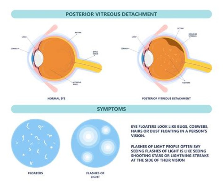 Why do I see a bright circle when I close my eyes?