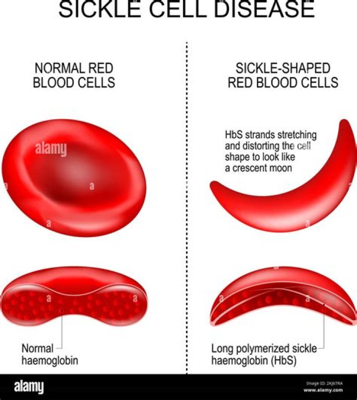 Why is a sickle curved?